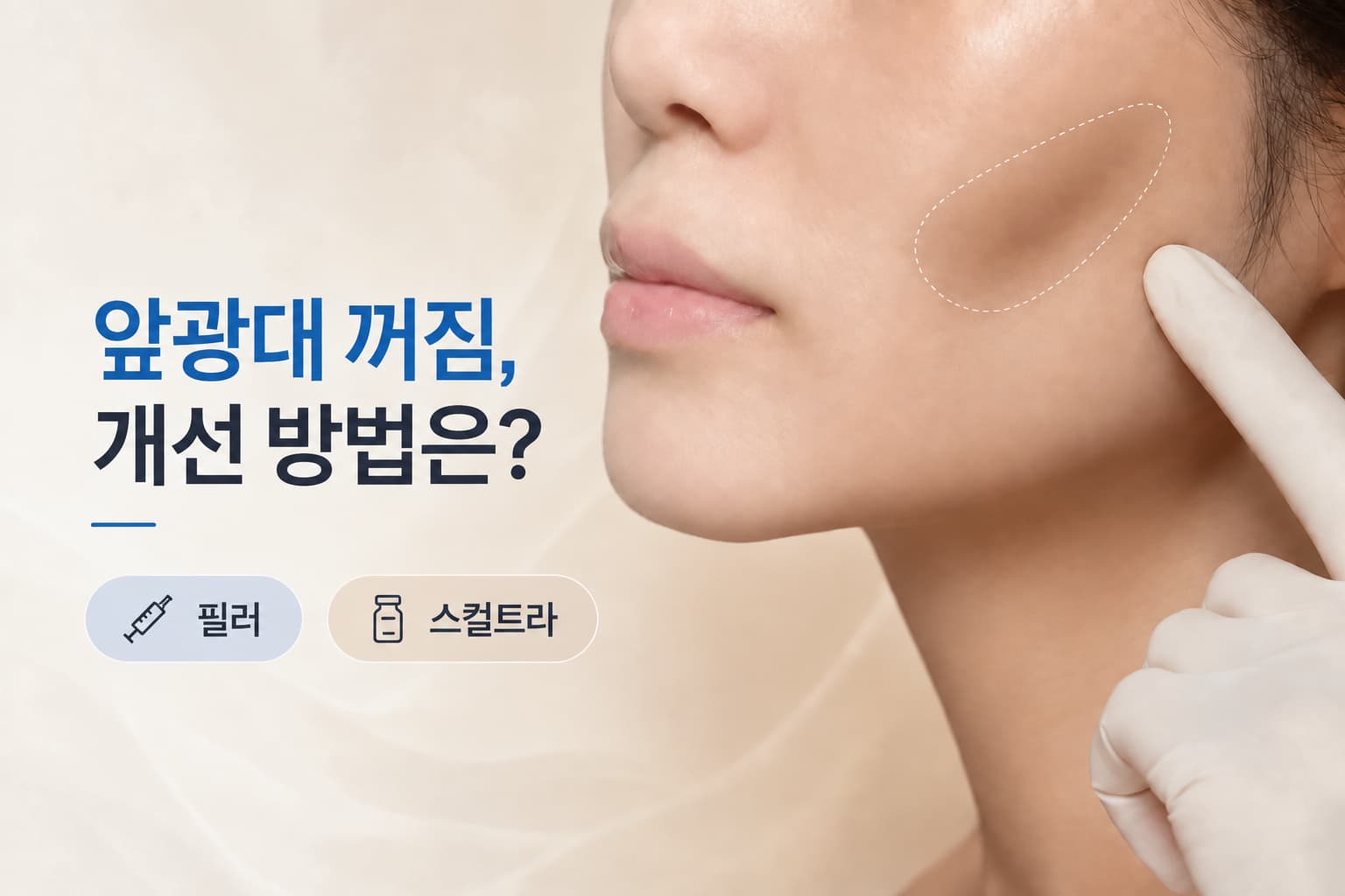 앞광대 꺼짐 개선_필러와 스컬트라 선택 기준은