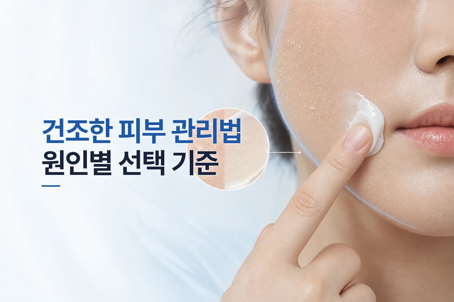 건조한 피부 관리법_보습해도 계속 당기는 이유와 개선 방법