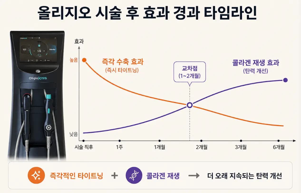 부산 올리지오 시술 후 효과가 나타나는 타임라인 그래프